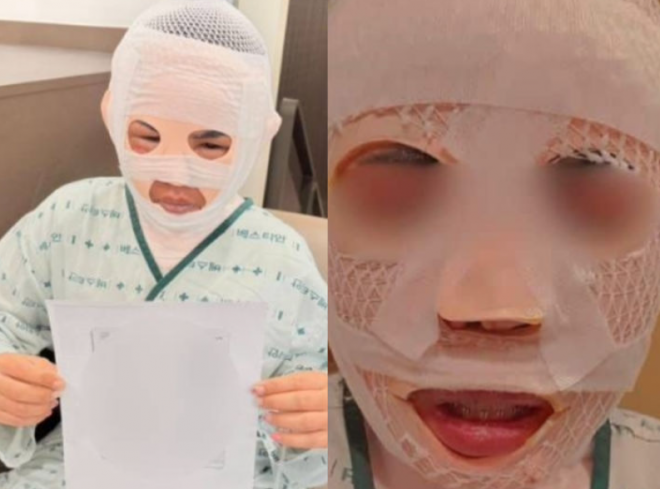 “다른 남자 만날까봐”…태국인 아내에 끓는 물 부은 한국인 남편 구속 “다른 남자 만날까봐”…태국인 아내에 끓는 물 부은 한국인 남편 구속